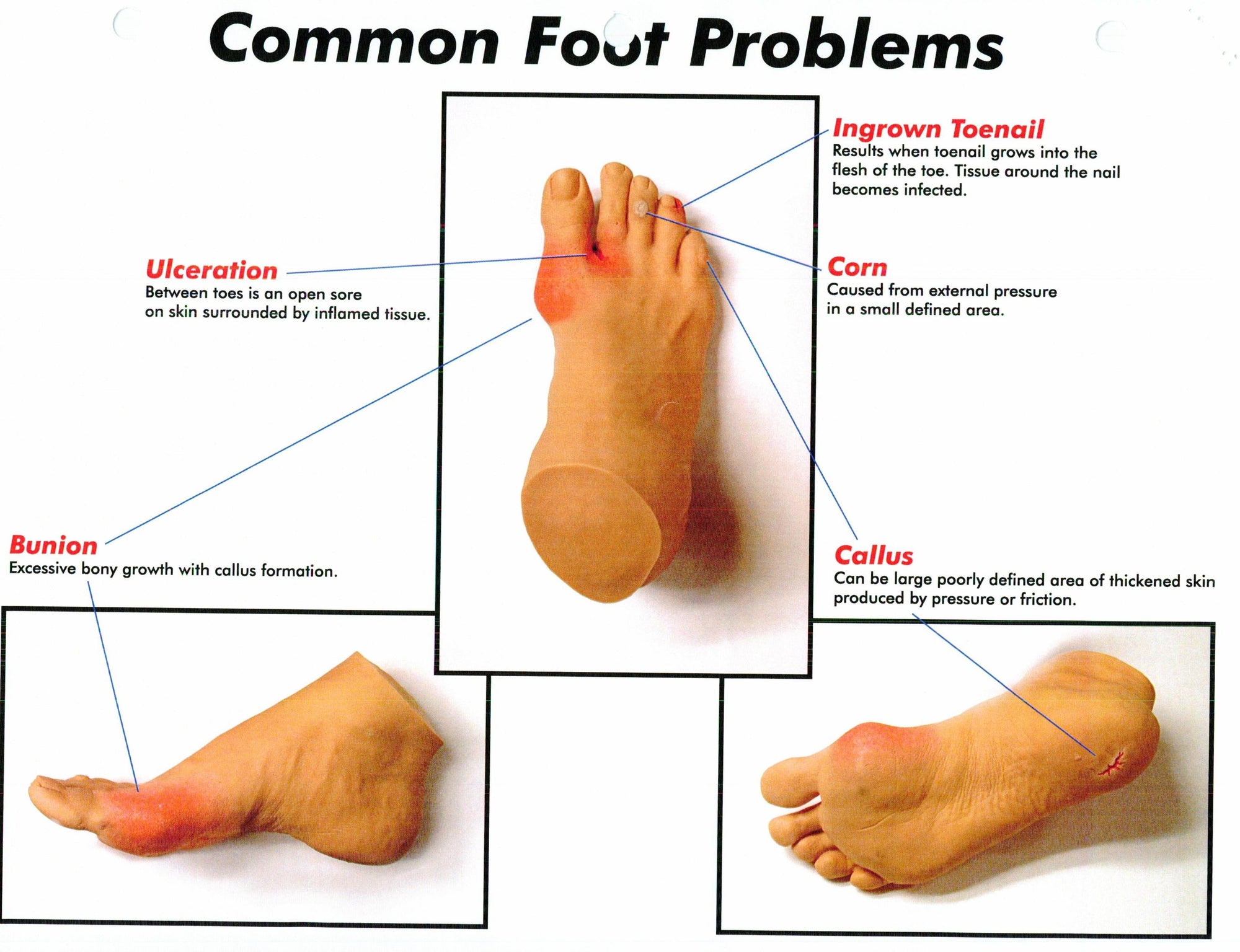 Understanding Common Foot Problems: A Comprehensive Guide