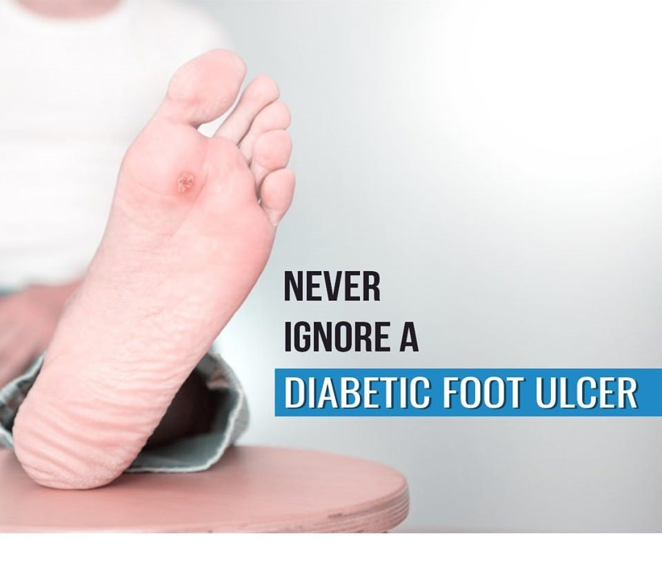 Conquer Foot Ulcers: Expert Prevention & Natural Remedies Unveiled