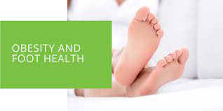 Link between Obesity & Foot Health