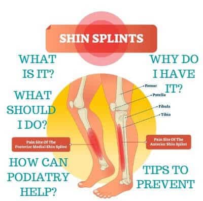 Shin Splints Decoded: Empowering Insights for Effortless Recovery